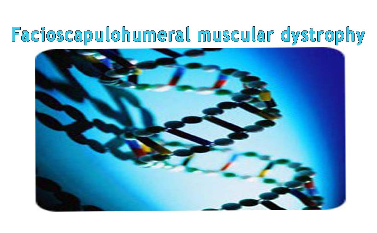 2015-facioscapulohumeral-muscular-dystrophy-evidenza