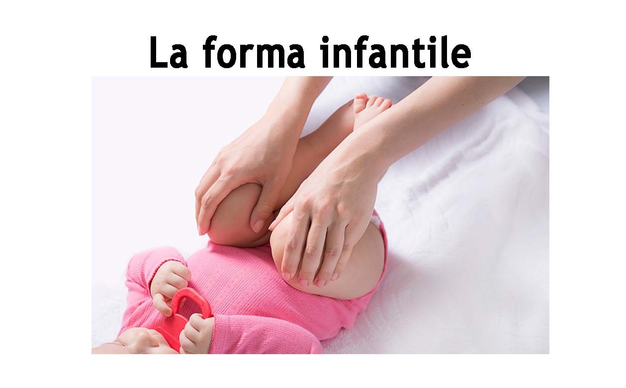 2015-laformainfantile-evidenza